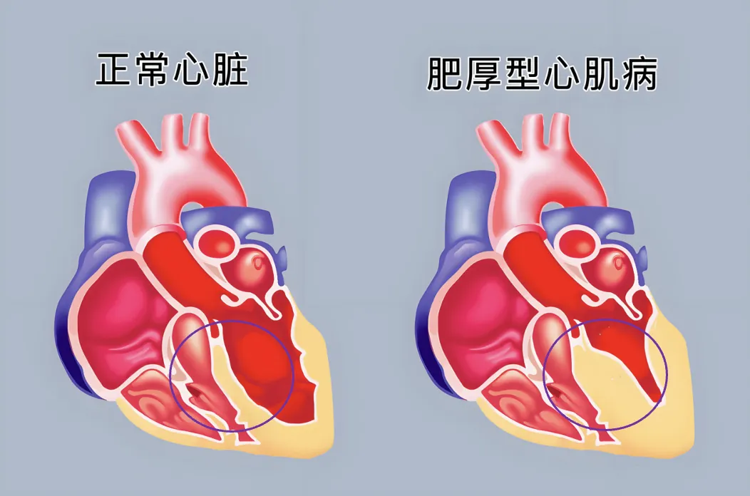 8d2c58a40be66b0c6a4df58991798cc7.png